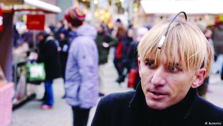 তালা খুলতে শরীরে চিপ